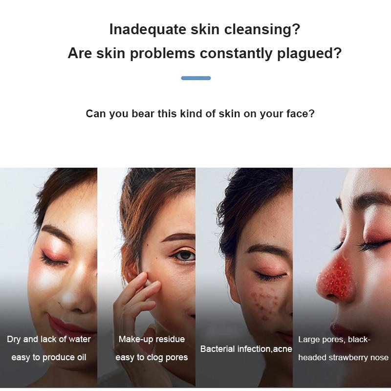 Electric Blackhead Vacuum Remover